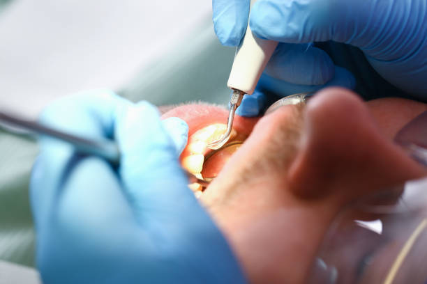 Best Emergency Dental Services for Seniors in Ladd, IL